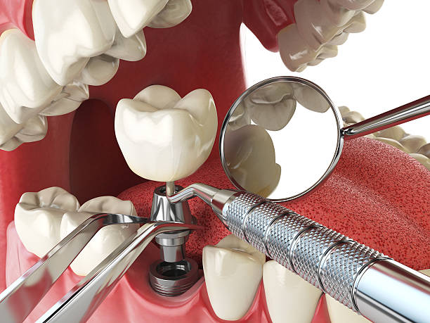 Best Emergency Dental Care for Broken or Chipped Teeth in Tubac, AZ